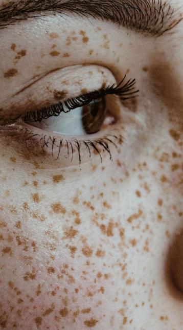 close-up of brown eye and freckles
